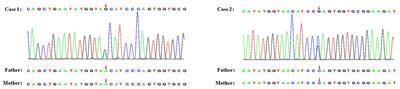 Two Children With Novel TRPC6 Spontaneous Missense Mutations and Atypical Phenotype: A Case Report and Literature Review